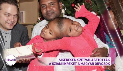 Sztvlasztottk a magyar orvosok a fejknl sszentt szimi ikreket