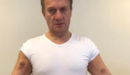 Varju L�szl� feljelent�st tett testi s�rt�s miatt